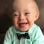 Image result for Down Syndrome That Affects System