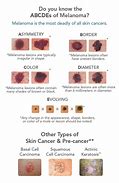 Image result for Skin Cancer