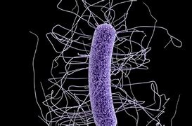 Image result for Superbugs Bacteria