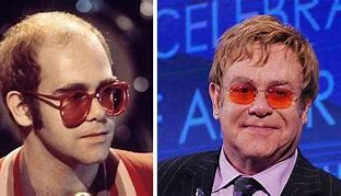 Image result for Elton John Younger Days