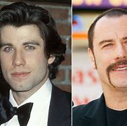 Image result for John Travolta Hair Loss