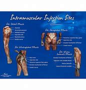 Image result for Gluteus IM Injection Sites