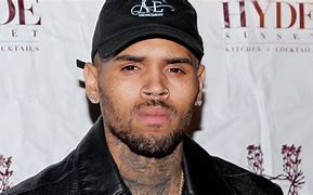 Image result for Chris Brown Bleeding