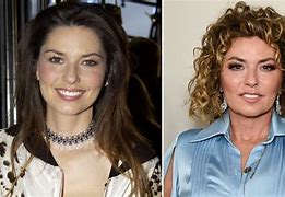 Image result for Shania Twain Face Change