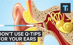 Image result for Cleaning Out Ear Wax