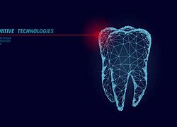 Image result for Dental Implant Logo