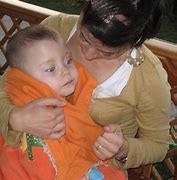 Image result for Sarp with Canavan Disease