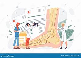 Image result for Foot Surgery Cartoon