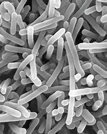 Image result for Listeria Monocytogenes Microscope