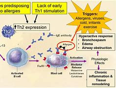 Image result for Atopic Asthma