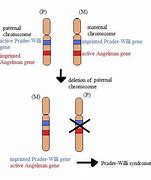Image result for Prader-Willi Syndrome Chromosome