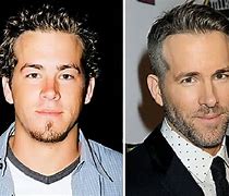 Image result for Ryan Reynolds Before and After