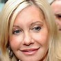 Image result for Olivia Newton-John Plastic Surgery Before and After