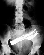 Image result for Crazy X rays