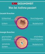 Image result for Herbs for Asthma