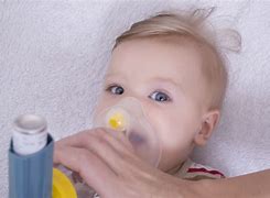 Image result for Infant Asthma