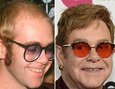 Image result for Elton John Gray Hair