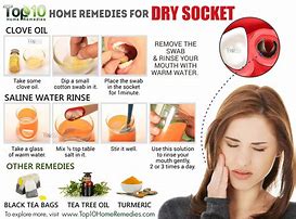 Image result for Natural Remedies for Anxiety and Stress