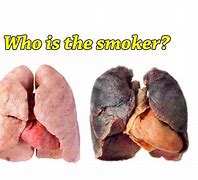 Image result for Cigarette Lungs