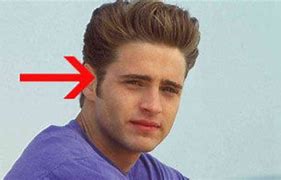 Image result for 90210 Sideburns