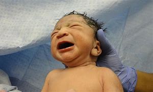 Image result for Dead Baby