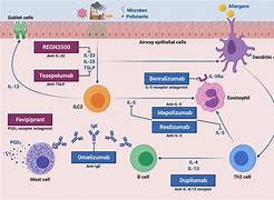 Image result for Asthma Treatment Diagram