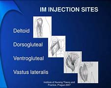 Image result for Intramuscular Sites