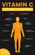 Image result for Signs of Vitamin C Overdose