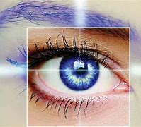 Image result for Novartis Eye