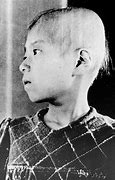 Image result for Radiation From Hiroshima Bomb