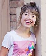 Image result for Down Syndrome Women