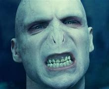 Image result for Voldemort Has No Nose