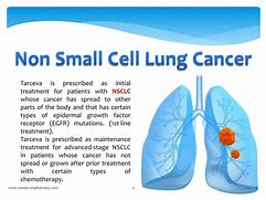 Image result for Non-Small Cell Lung Cancer Treatment