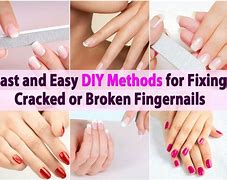 Image result for Repairing Cracked Nail