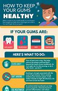 Image result for Healthy Teeth and Gums