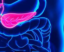 Image result for Stage 4 Pancreatic Cancer