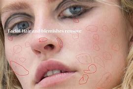 Image result for Remove Skin Blemishes