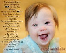 Image result for Down Syndrome Quotes