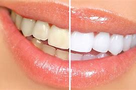 Image result for Natural White Teeth