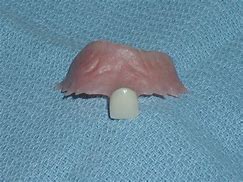 Image result for What Is a Dental Flipper