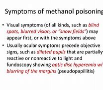 Image result for Methanol Poisoning