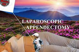 Image result for Lap Appy Surgery