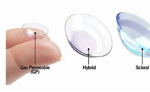 Image result for Keratoconus Contact Lenses