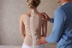 Image result for Scoliosis