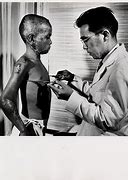 Image result for Hiroshima Victim Pictures