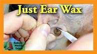 Image result for DIY Ear Wax Removal