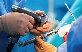 Image result for Orthopedic Surgeon Tools