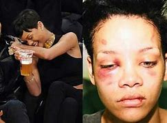 Image result for Chris Brown Punch Rihanna