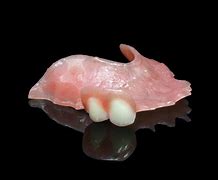 Image result for Stayplate Dental