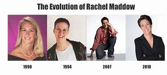 Image result for Rachel Maddow Before Surgery